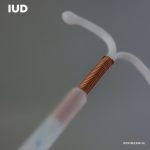 IUD (Intra-Uterine Device)