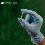Implan